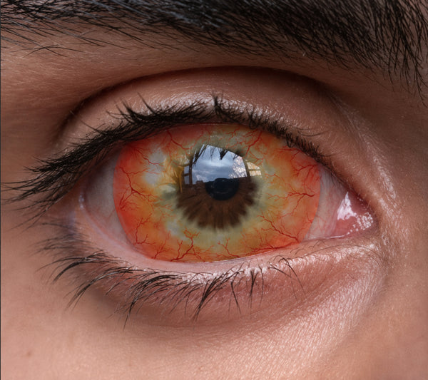 【Sclera】Ghost
