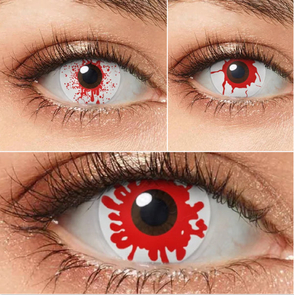 Hyperémie (3 modèles)