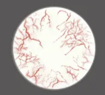 【Blind】Kingdom 3