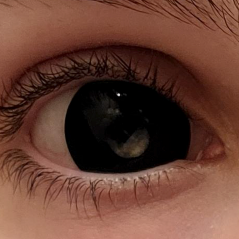 【Mini Scléra】Black (17mm)