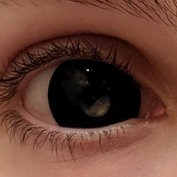 【Mini Scléra】Black (17mm)