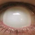 White (Blind) - lentille sclérale mini ゾンビ cosplay/Halloween ZenKon