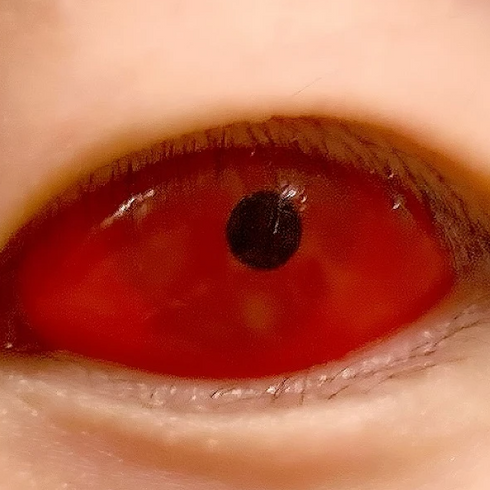 【Scléra】Red V2 (petite pupille)