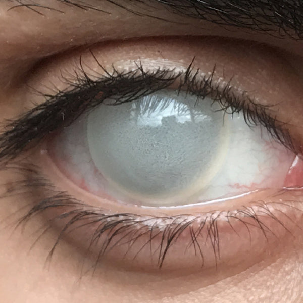 【ブラインド】スキン【視界減少】- SFX-EYES 全眼カラコン 特殊カラコン コスプレ ハロウイン オーダーメイド アニメ 漫画 度付き 度入り 度あり